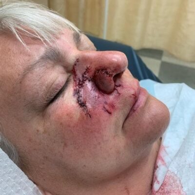 Cindy Zellers in hospital after incident