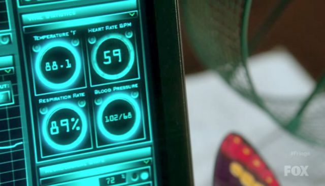 Fringe S4x03 - Vitals