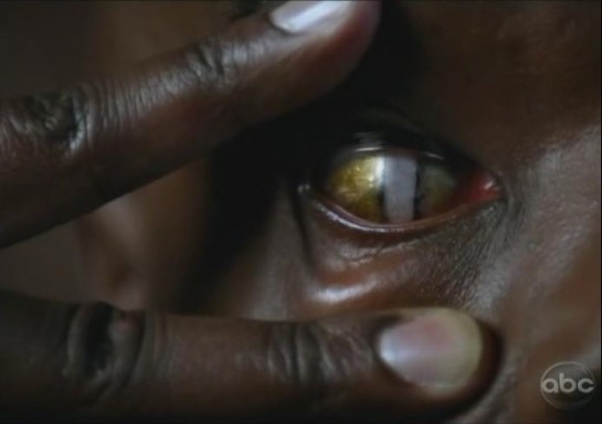 Ryan's real eye