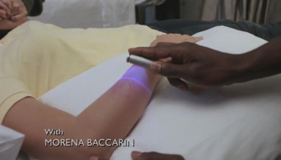 V Series - Healing Burn V Series - Healing Burn